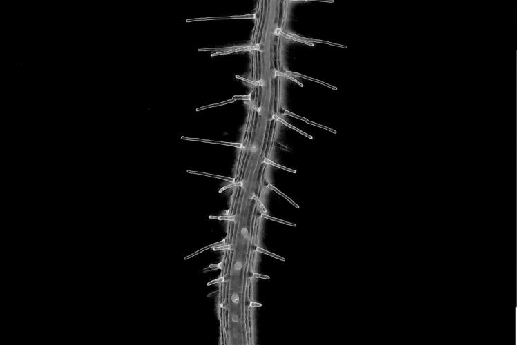 Arabidopsis root meristem and hairs