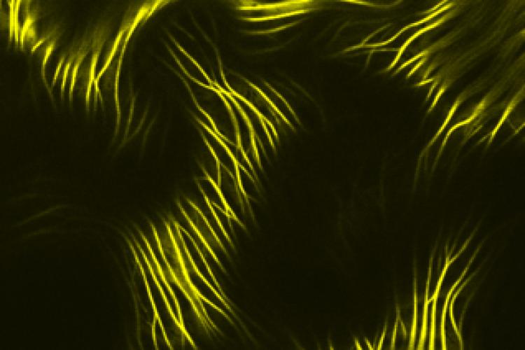 MAP65 microtubule bundling