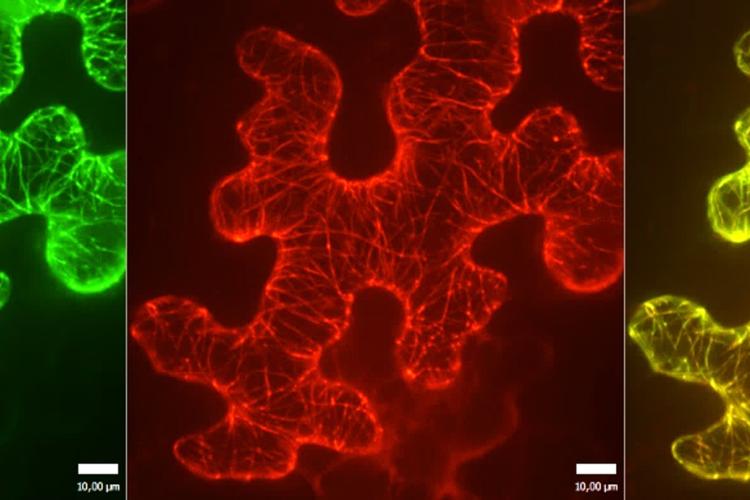 microtubules