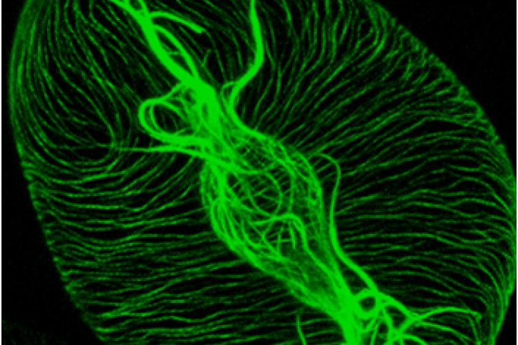 microtubules