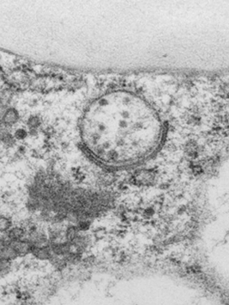 Transmission electron microscopy (TEM) image showing the formation of autophagosomes at endoplasmic reticulum-plasma membrane contact sites.